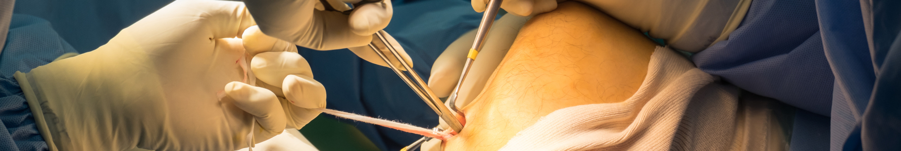 Więzadła kolana: lekarz operujący więzadło krzyżowe